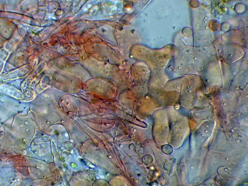 Chromelosporium carneum 10 - Hifas conidiógenas-006